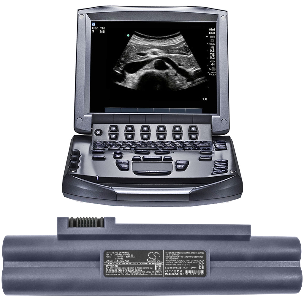 Sonosite Ultrasonic NanoMaxx